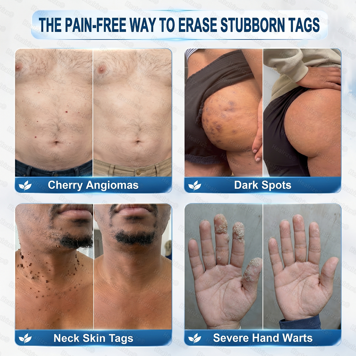 🔥 Upgrade to 4 Packs — Add 2 More & Save 80%